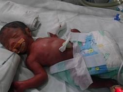 Mamathas Baby Was Born Extremely Premature At 26 Weeks. Please Support