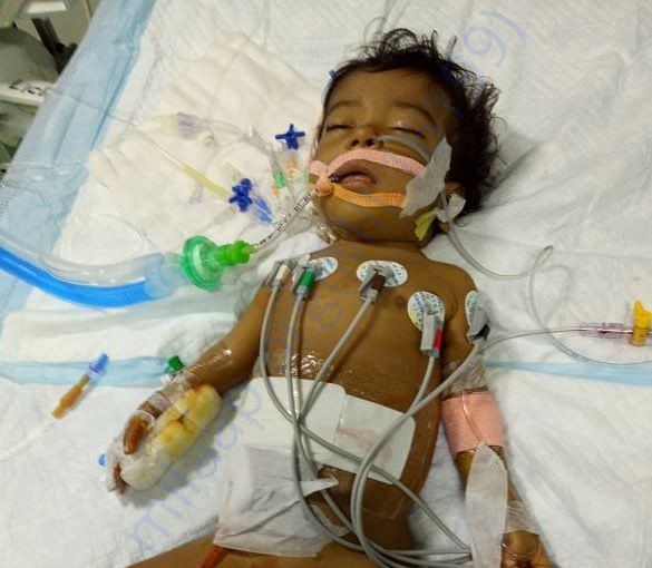 After Liver Transplantation- Currently in ICU