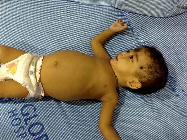 After Losing Two Babies, This Family Is Desperate To Save Their Child