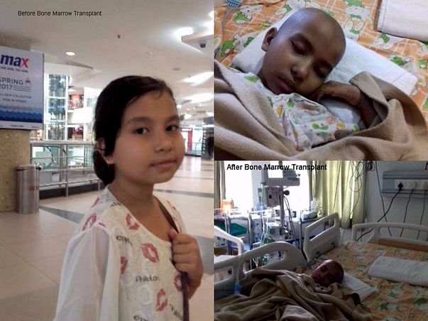 Help A Precious Daughter Pragya For Her Bone Marrow Treatment
