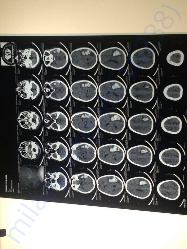 Nair hopsital 12