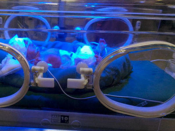 This New-Born Is Fighting Infections And Need Your Help To Stay Alive
