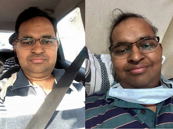 Vineet's fight against blood cancer (Please show your generosity)