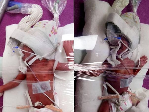 Help My New Born Twins Fight The Battle Of Life