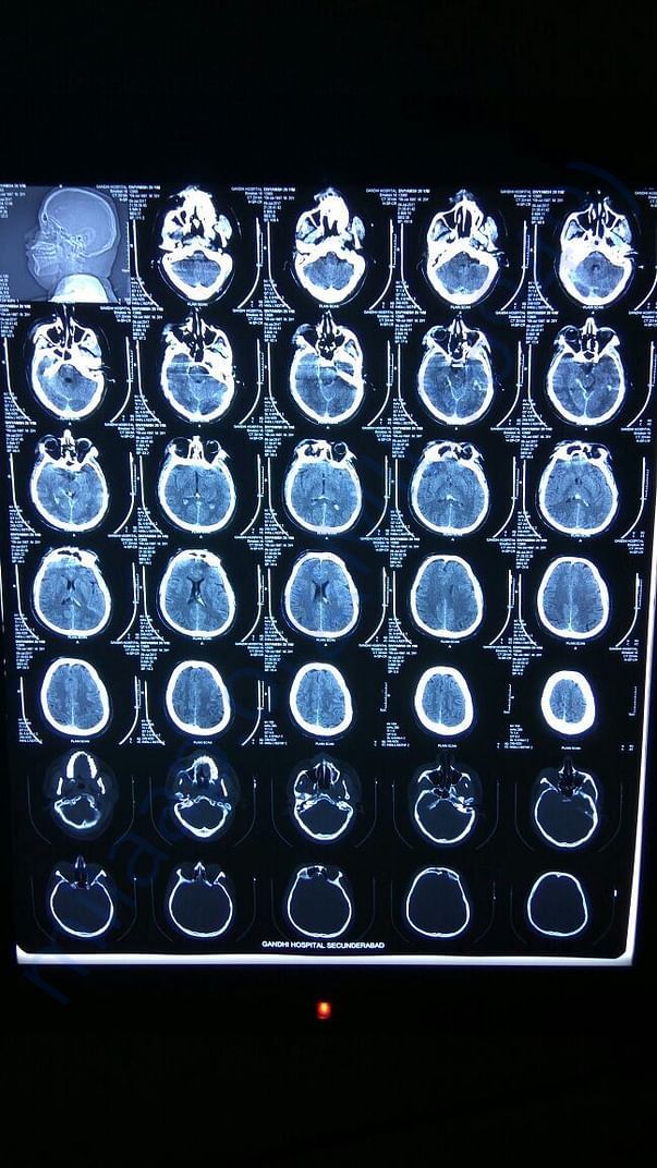 X-ray