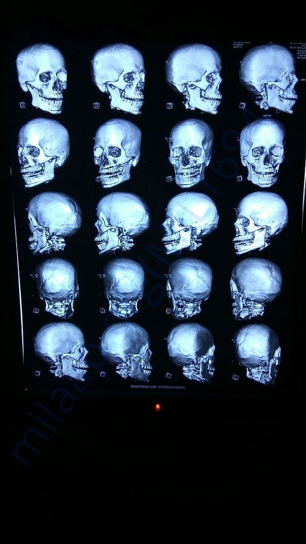X-ray 2