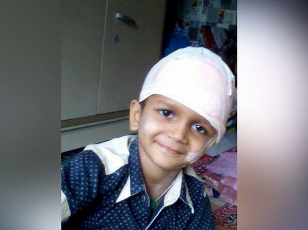 Help Durva Undergo A Crucial Brain Surgery