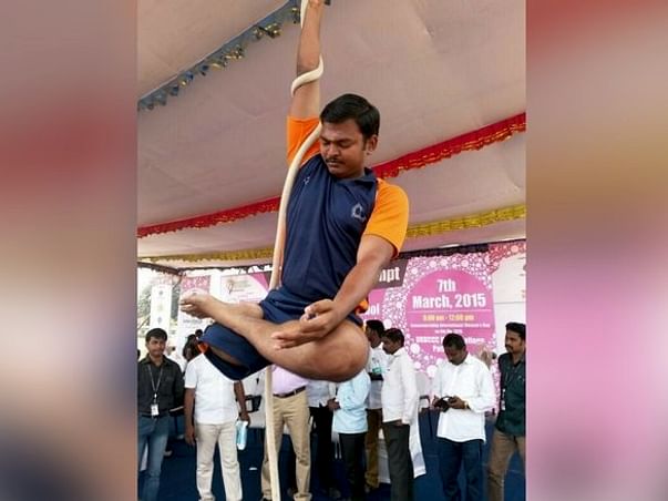 Help This Multi-Talented Man Walk Again With An Artificial Limb.