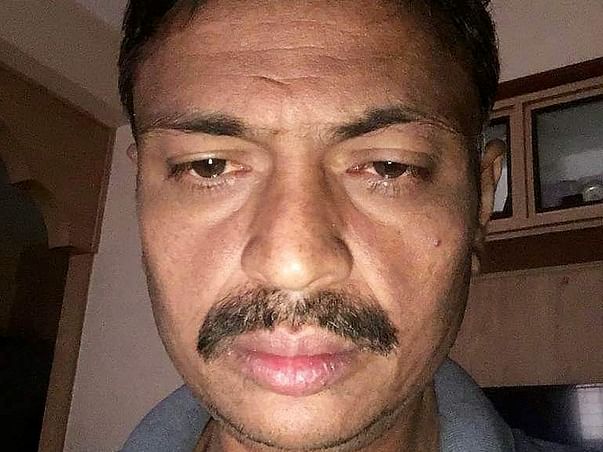 Help 44-Year-Old Man Undergo Liver Transplant