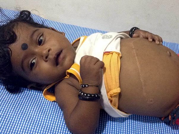 Help this 7-month-old undergo a liver transplant