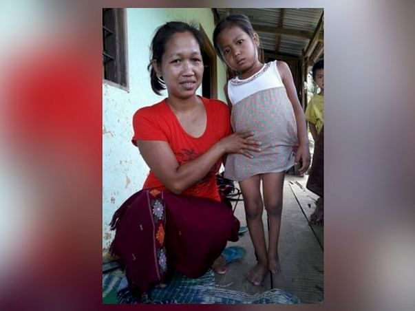 Help 6-Year-Old Themneiphal Recover From Rectovaginal Fistula