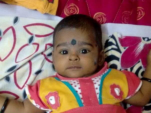 Help Baby Ridhi Undergo A Liver Transplant