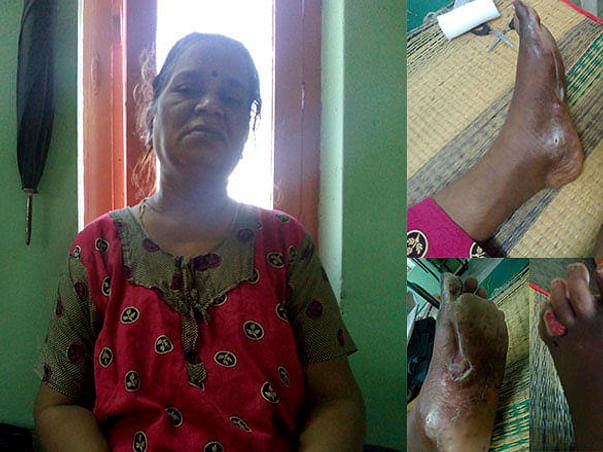 Help My Mother and make her to walk again