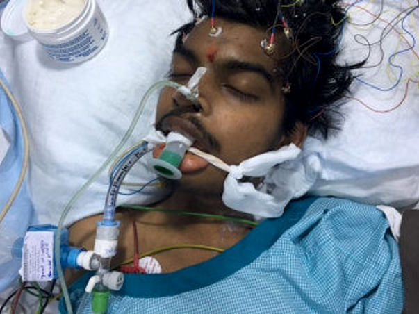 While Fighting Tuberculosis, The Medicines Were Killing Him