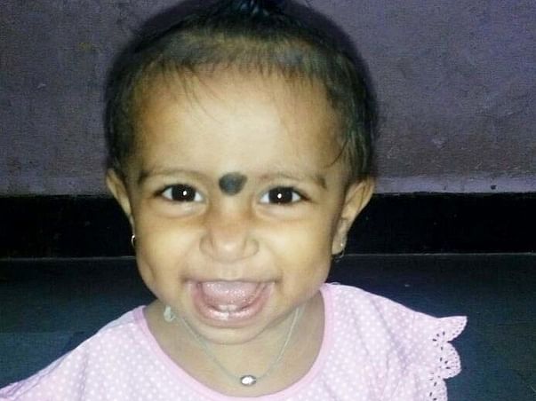 Need Helping Hands for Baby OVI DARSHAN SODEWALE suffering BoneMarrow