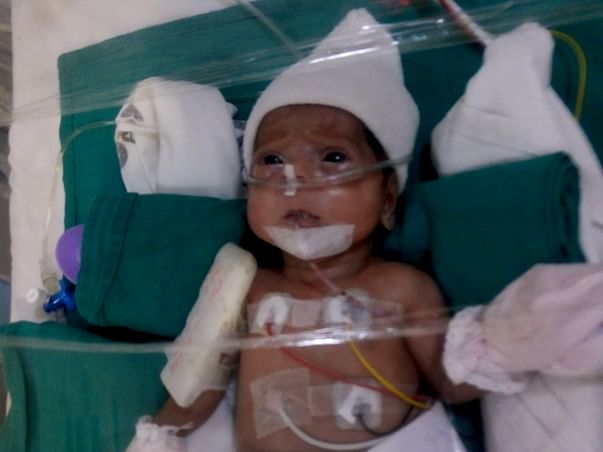 Help Preterm Twins Of Pallavi Suffering From Chronic Lung Disease