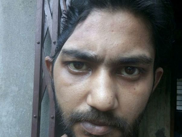 Support Suman A 28 years Old Young Man For His Brain Operation