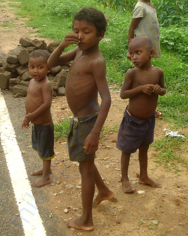 सड़कों किनारे खेलते कुपोषित बच्चे