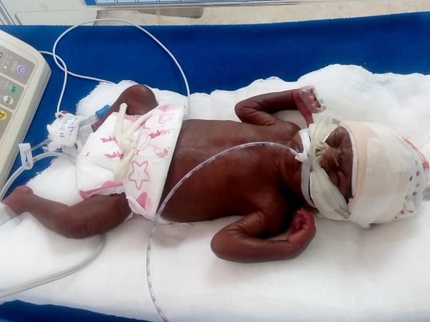 Help Ganesh To Save His 26-Week-Old Son