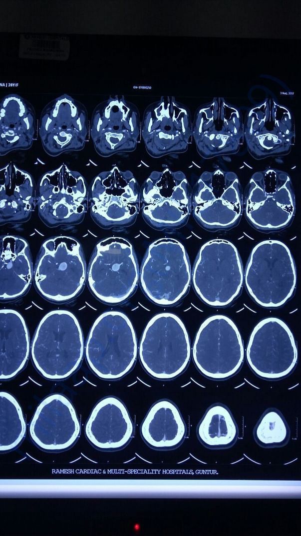 CTA BRAIN -3