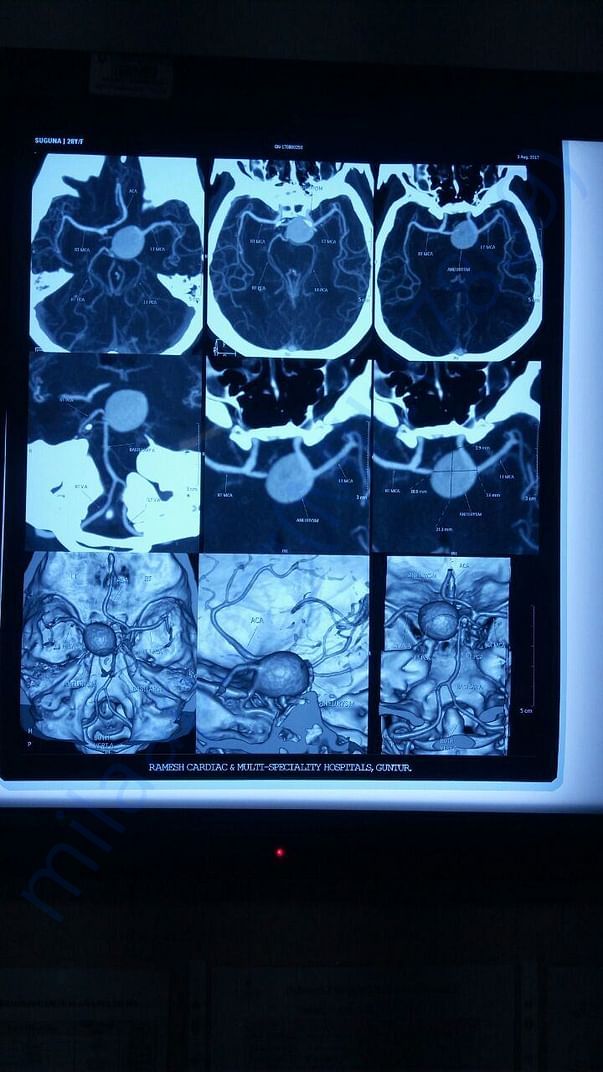 CTA BRAIN -4