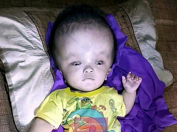 Mimin's Head Will Explode If You Don't Help Him