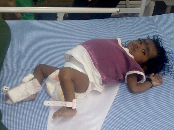 10-month-Old Rithvika Cries Herself To Sleep Every Single Night