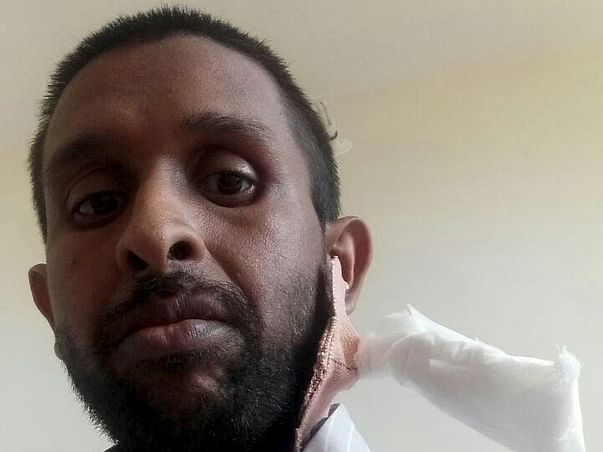 Help Murtuja Undergo Dialysis For His Kidney Failure