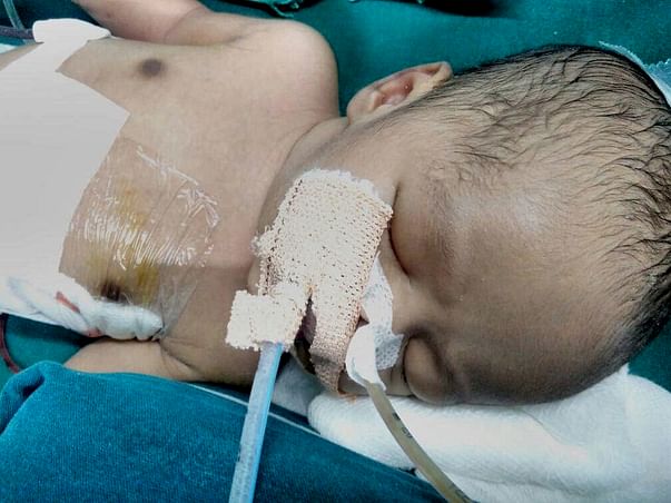 Baby Of Nazia Needs Your Help To Live