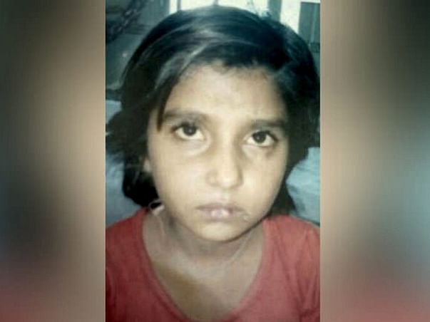 Help Little Anjali Undergo An Urgent Liver Transplant