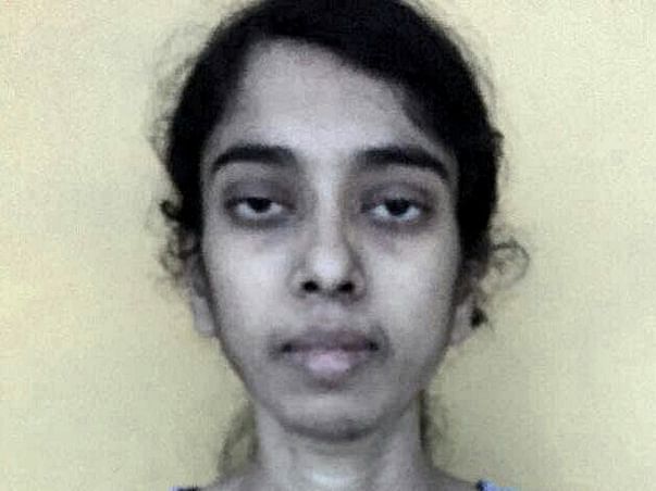 Help My Sister Kokila To Undergo Liver Transplant