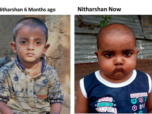 Help Nitharshan Undergo Stem Cell Transplant
