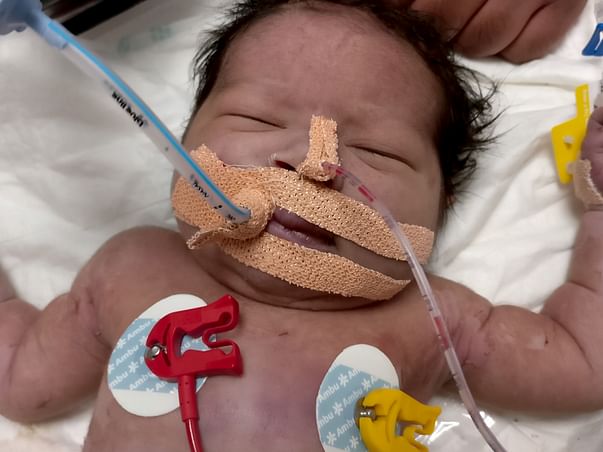 Baby of Reshma need our Help