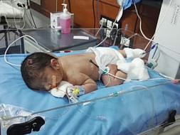 Help Baby Avyaan fight Pierre Robin Syndrome