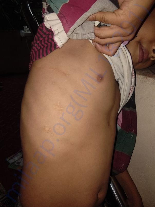 images of vardhan who got operated twice for his heart