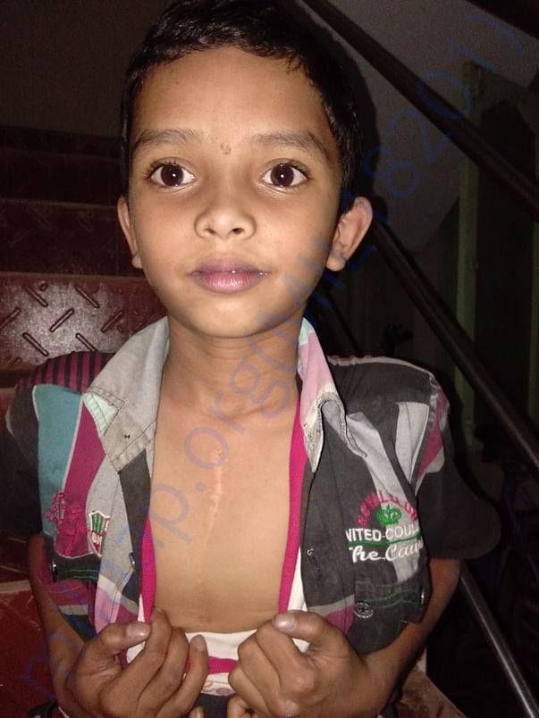 images of vardhan who got operated for his heart