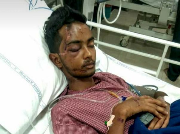 Need Money For A Friend's Skull fracture Operation