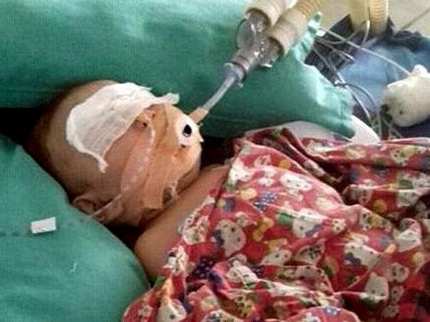 Help Snigdharaag Fighting Lung Infection and Spinal Chord Infections