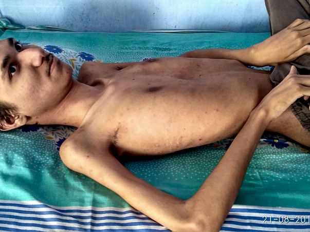 Help Rushit suffering from Muscular Dystrophy (DMD) a genetic disorder