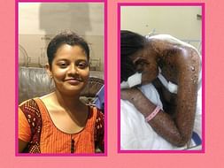 Help priyanka in fighting skin disease steven johnson syndrome