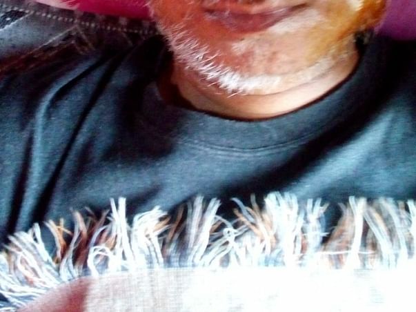 Save a life help Anil to survive