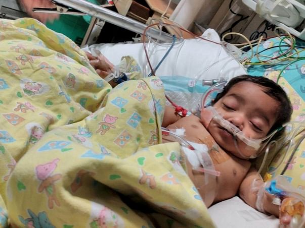 Baby Hamza Was Born With A Missing Valve In His Heart