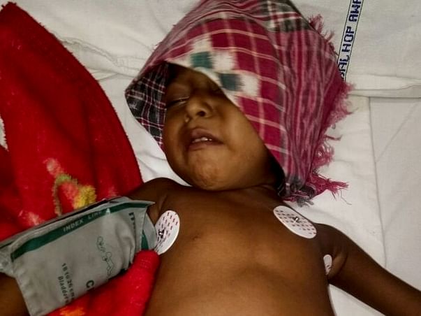 Help this 4-year-old fight chronic liver disease