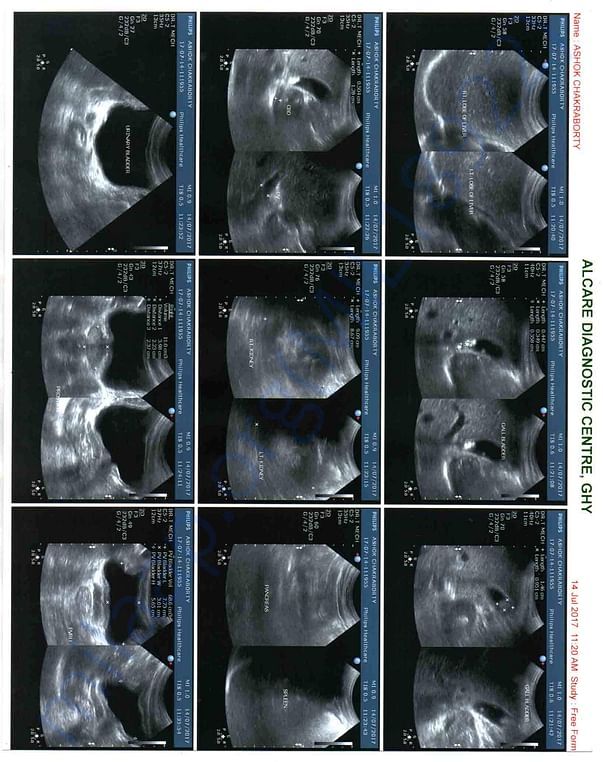 Sonography