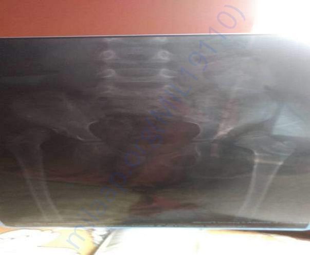 Xray