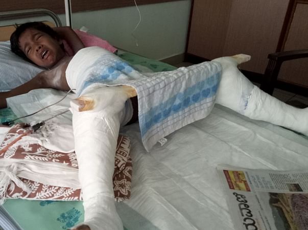 Help For My Daughter's Dislocated Hip Surgery