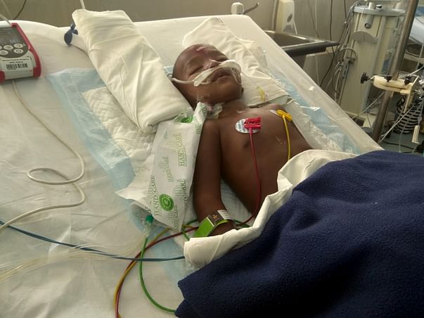 Help Jay Come Out Of Ventilator Support