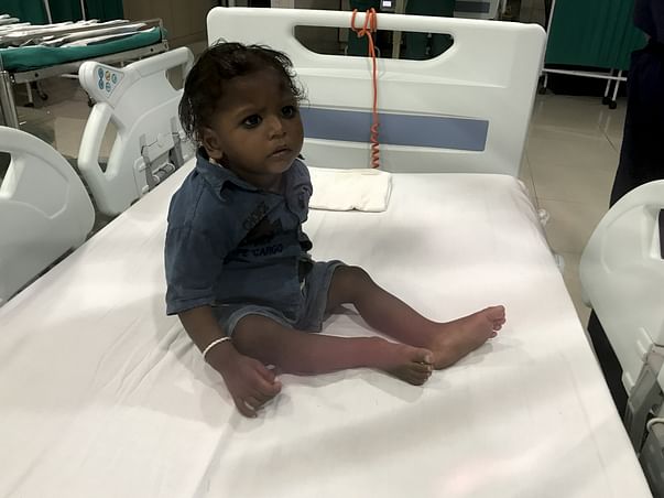 Urgent: 18-month-old Baby Mohit Needs A Heart Surgery To Live