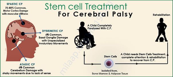 treatment procedure