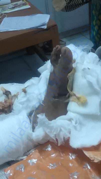 left leg no life in it